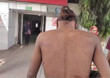 क्राइम ब्रांच का थर्ड डिग्री टॉर्चर-पीड़ित ने पुलिस पर लगाएं गंभीर आरोप,सरकार से न्याय की गुहार।