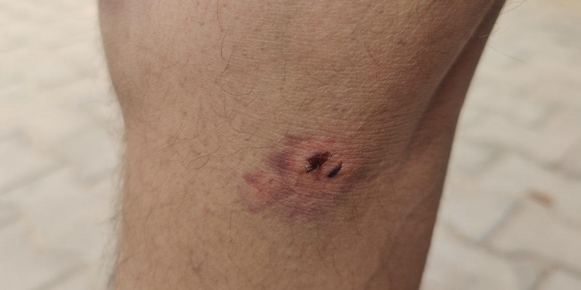 सोहना में व्यापारी से हुई लूटपाट की घटना!