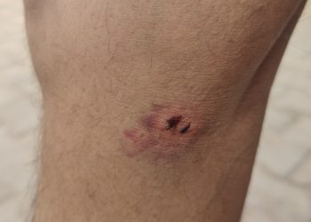 सोहना में व्यापारी से हुई लूटपाट की घटना!