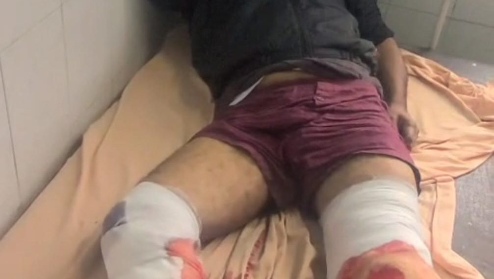 पिनगवां में सर्राफा दुकान से लाखों  की चोरी करने वाला एक लाख का इनामी बदमाश पुलिस मुठभेड़ के बाद काबू..